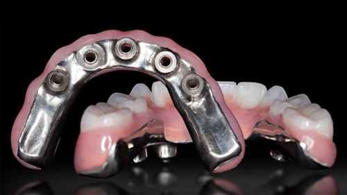 Fixed Hybrid Dentures Alternative treatment