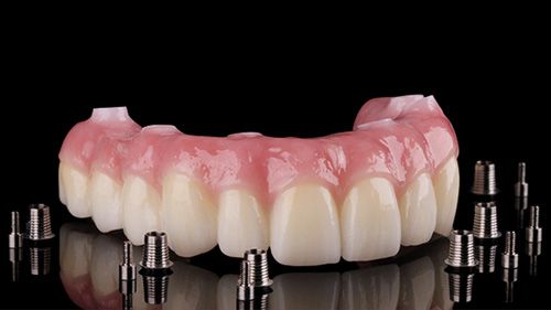 Prettau Bridge Alternative Treatment