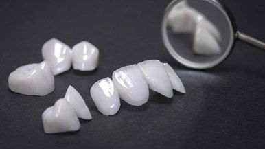 Crowns and veneers alternative