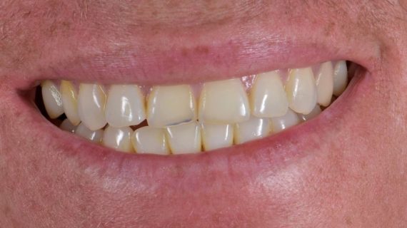 Cancun Dental Specialists