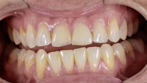 Cancun Dental Specialists