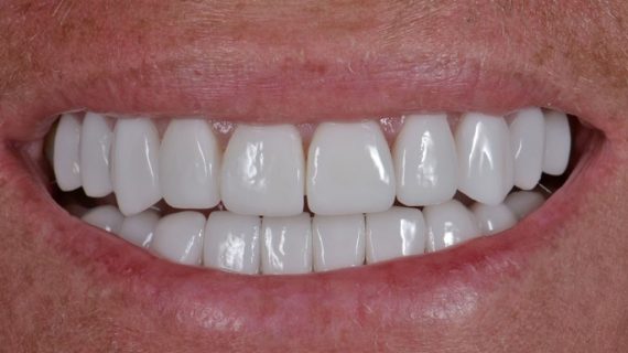 Cancun Dental Specialists