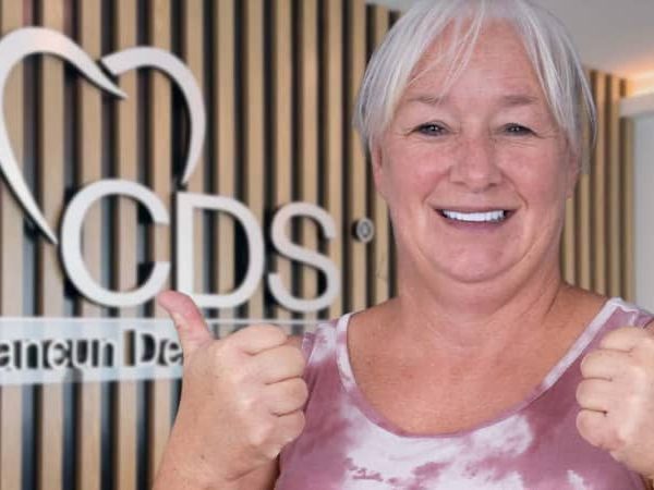 All on 4 Mexico: The definitive guide to recover your smile