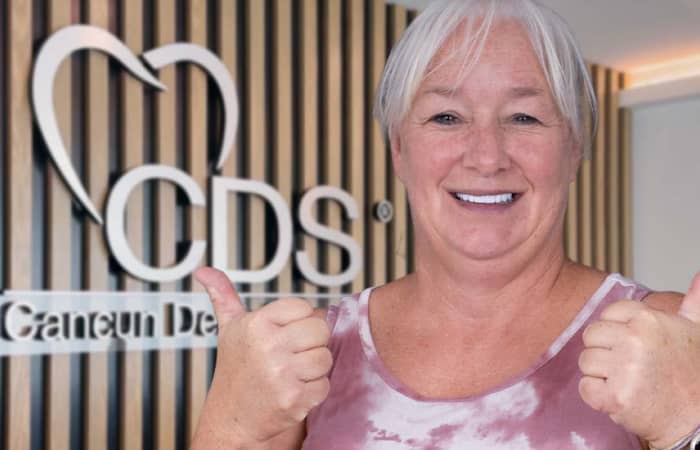 All on 4 Mexico: The definitive guide to recover your smile