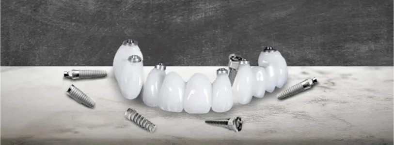 dental implants teeth